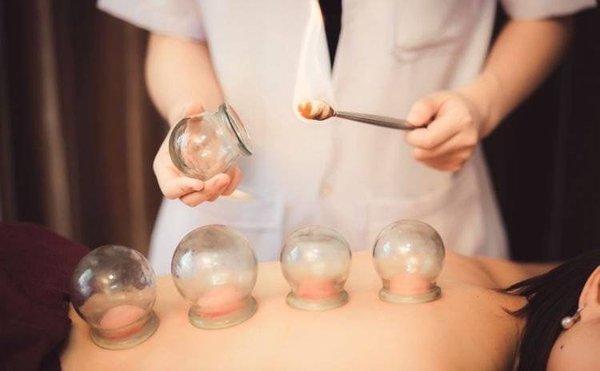 Cupping