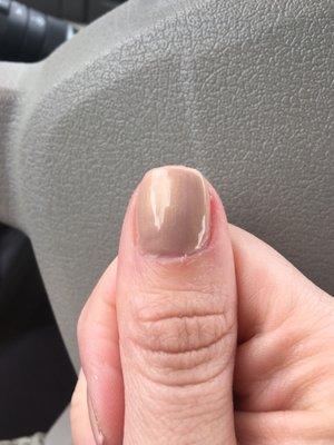 Visible cut on my cuticle.