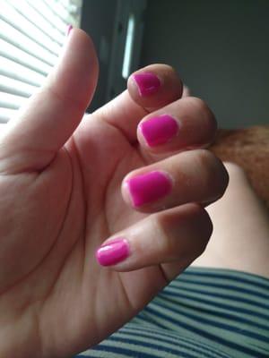 Peeling and raw finger tips after gel manicure