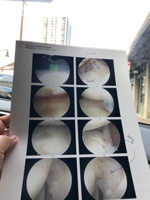 my surgery photos- looks kinda extra- terrestrial to me...