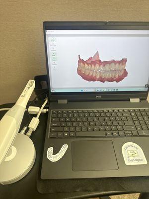 We use digital intraoral scanning for crowns, bridges, implants, orthodontics, and more!