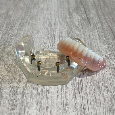 Sarasota Dentures and Implants