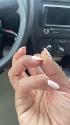 Badly filed and cut cuticle area