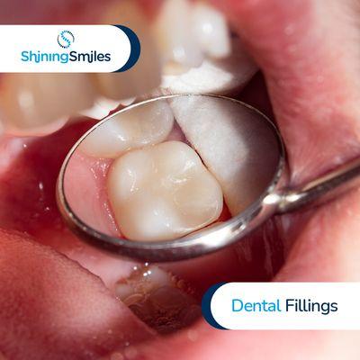 Dental Fillings at Shining Smiles Family Dentistry in Marietta, GA