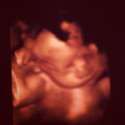 Our baby girl showing us her muscular arms at 28 weeks!