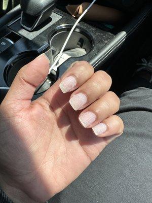 damaged nails