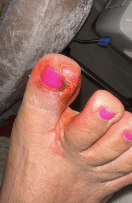 ‼My mom contracted a severe toe infection after visiting this salon in May.‼