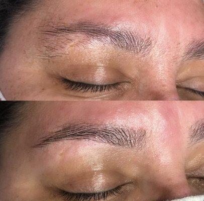 Brow shaping