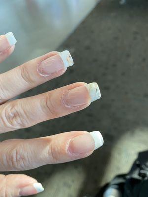 Gel manicure lifting and separating from nails in less than 10 days.