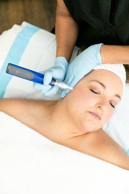 We recommend microneedling or micropenning to brighten the skin and address texture.