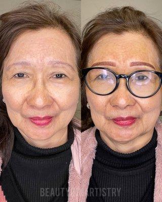 Brow correction