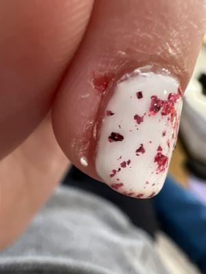 Huge gouge out of my skin, and polish all over my cuticles.