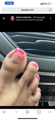 Pedicure disaster