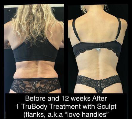 TruBody Treatment