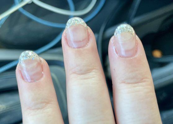 Acrylic nail fill