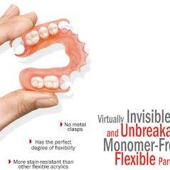 our flexible partial denture