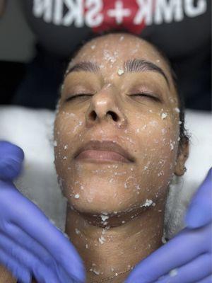 Icy part of the facial