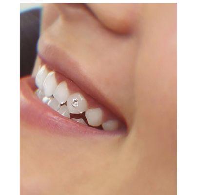 Affordable tooth gems