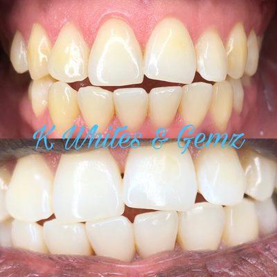 60 minute whitening session