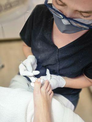 Getting out under nail calluses