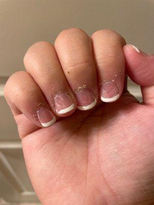 My nails never look this bad