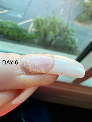 Day 6 & almost every nail had this kind of huge lifting issue & looked like straight trash.