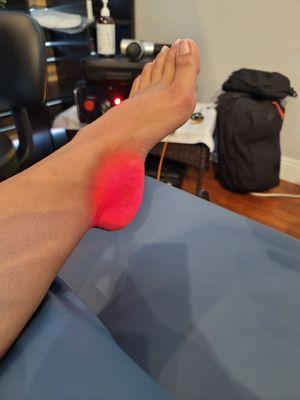 The cold laser therapy healed my plantar fasciitis.