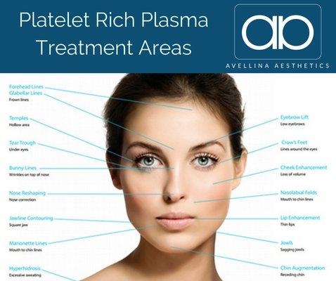 We are proud to bring latest and clinically-proven natural therapies for anti-aging - Platelet Rich Plasma (PRP) known as Vampire Facial.