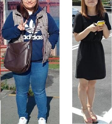 She is One of my patients. she loose 80lb. Before&After