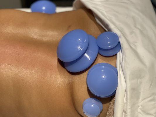 Cupping focusing on Glutes n lower back !!!