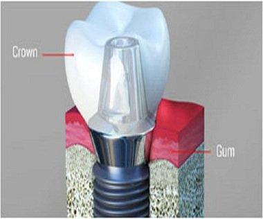 New Image Dental