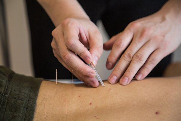 Lu Acupuncture NY PC