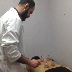 Hijama