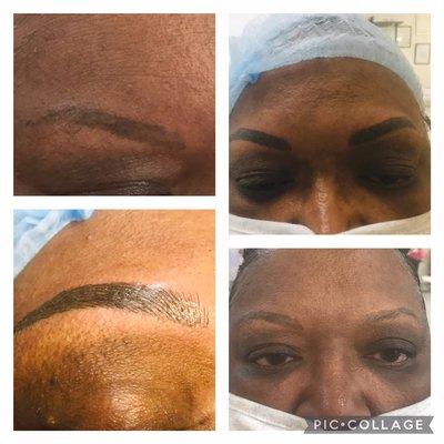 Microblading