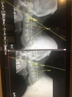 Bottom: Before Top: After