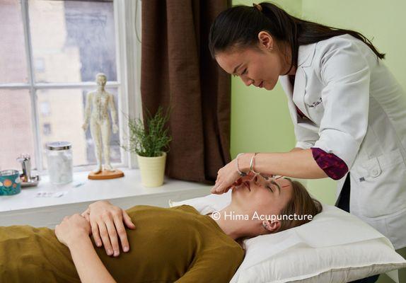 Snow Xia, L.Ac. Midtown, NoMad acupuncturist | Giving an acupuncture treatment for sinus headache and anxiety.