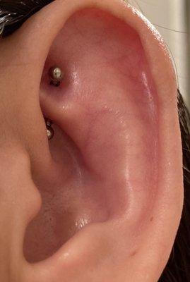 Left ear 3 hours after.