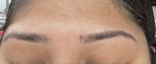 Eyebrow uneven