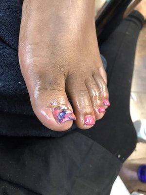 Acrylic on toes