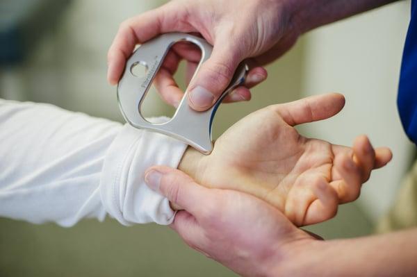 Treating carpal tunnel syndrome