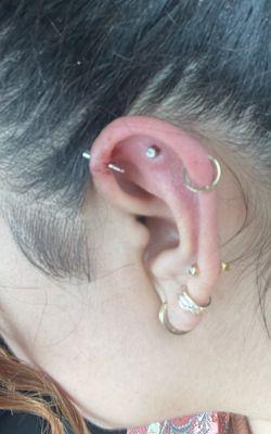 Botched forward helix