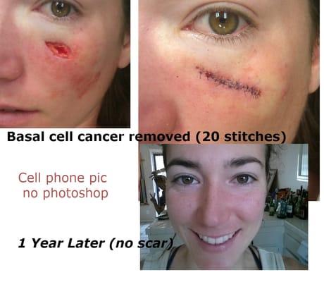 Dr. Said was surprised but let me take a cell phone pic for my documents. Before and after one year apart, 'nuf Said:P I'm happy