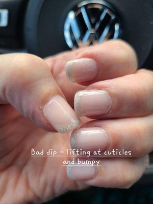 Bumpy nails and dip is lifting