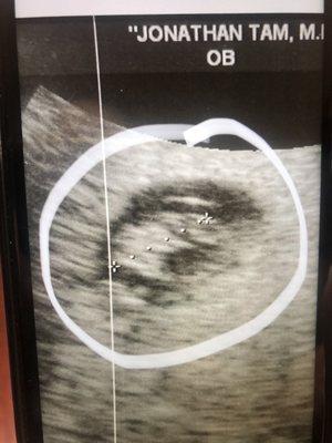 Photo sent by patient after ultrasound examination after pregnancy