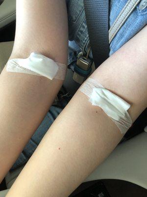 Got poke 10 times on left arm because "Amy R" can't find vein blood leaked out. Other nurse start all over on the right arm.