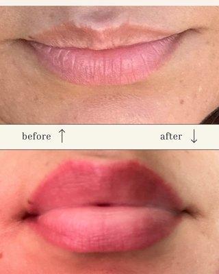 Before and after lip blush.