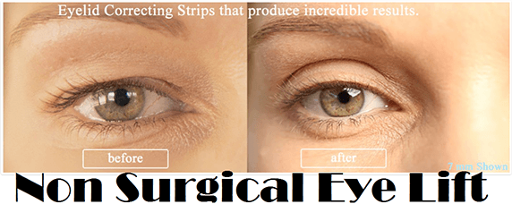 Look 10 years younger instantly with non-surgical eyelid strips