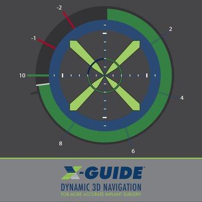 New Technology - Precise implant placement using X-Guide Navigation