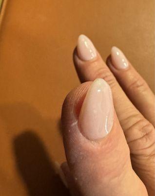 Awful first finger, crooked nail.