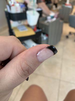 Not cleaned cuticles